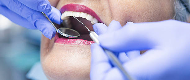 Best Emergency Dental Extractions in Alvin, TX